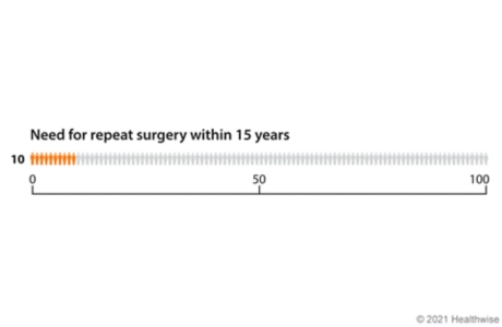 Graph with 100 figures, showing 10 figures colored to represent how many need repeat hip replacement surgery within 15 years.