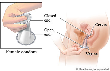 How to insert a female condom