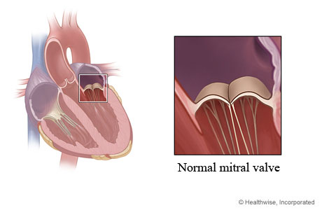 Location of mitral valve in heart showing normal valve