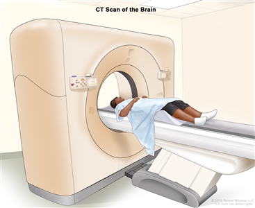 Computed tomography (CT) scan of the brain; drawing shows a patient lying on a table that slides through the CT scanner, which takes x-ray pictures of the brain.