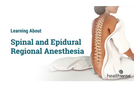 Learning About Spinal and Epidural Regional Anesthesia