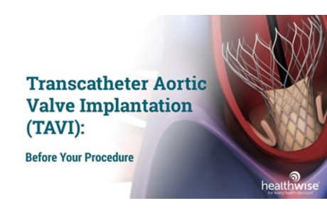 Transcatheter Aortic Valve Implantation (TAVI): Before Your Procedure