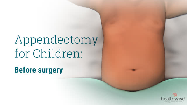 Appendectomy for Children: Before Surgery