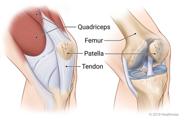Alt text: Bent knee joint, showing quadriceps becoming the patellar tendon and, along with bone (femur), connecting to the patella (kneecap) from above