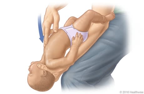 Choking rescue procedure (Heimlich maneuver) for a small child.