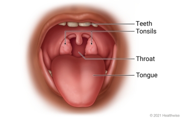 Open mouth, showing throat, tonsils, tongue, and teeth.