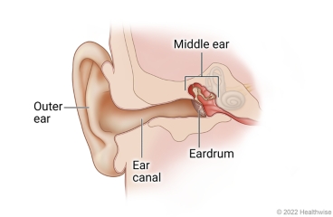 Anatomy of child's ear, showing outer ear, ear canal, eardrum, and middle ear.