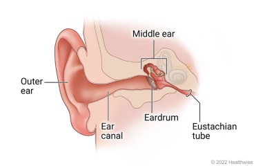 Anatomy of child's ear, showing outer ear, ear canal, eardrum, middle ear, and eustachian tube.