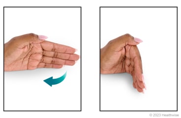 Relaxed fingers and finger tendon gliding positions. (A) Relaxed