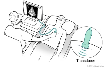 Person lying down for echocardiogram, showing transducer moved across chest, sending sound waves into chest, and picture of heart showing on screen.