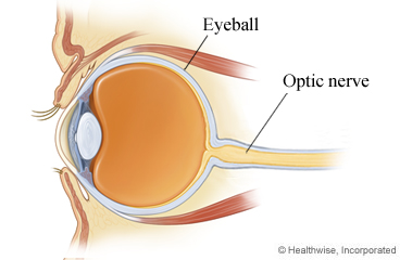 Eyeball and optic nerve