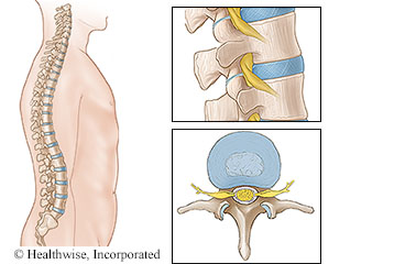 Spine and vertebrae