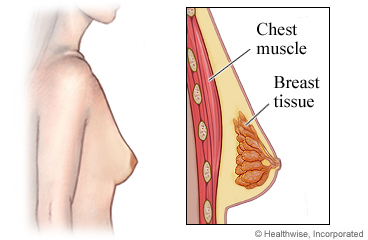 TMR International Hospital - Is It Normal To Have Back Pain From Your  Breasts? Breasts are an unusual cause of acute back pain, but for women  with larger breasts, they are one