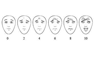 Pain scale showing faces with increasing pain from zero with no pain to 10 with the worst pain