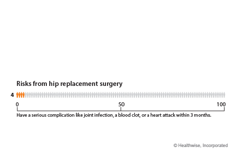 Out of 100 people who have hip replacement surgery, 4 will have a serious complication like joint infection, a blood clot, or a heart attack within 3 months.