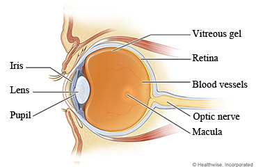 Parts of the eye, showing the iris, lens, and pupil in front, and vitreous gel, blood vessels, macula, retina, and optic nerve in back.
