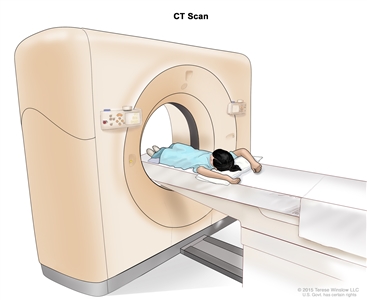 Computed tomography (CT) scan of the abdomen; drawing shows a child lying on a table that slides through the CT scanner, which takes x-ray pictures of the inside of the abdomen.