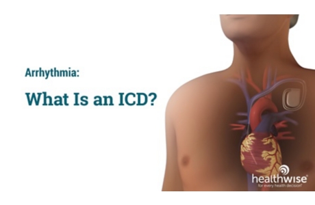 Arrhythmia: What Is an ICD?