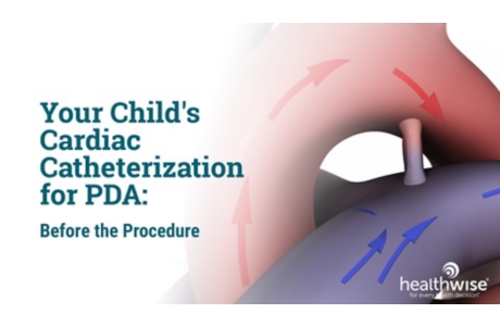 Your Child's Cardiac Catheterization for PDA: Before the Procedure