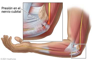 Si utilizas medias de compresión, mejor que sea para ayudar a la  recuperación, según las últimas evidencias