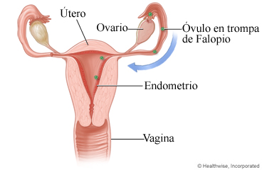 Aprenda sobre el dolor pélvico intermenstrual (dolor durante la