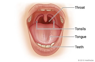 Open mouth, showing throat, tonsils, tongue, and teeth