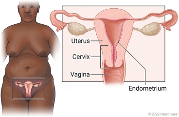 Female reproductive organs in pelvis, with close-up of uterus, cervix, vagina, and endometrium.