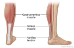 Calf of lower leg, showing gastrocnemius muscle, soleus muscle, and Achilles tendon.