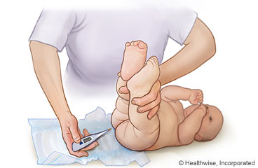 Taking a baby's rectal temperature