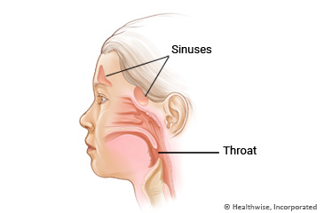 Sinuses and throat in a child