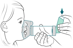 Una persona presiona un inhalador para rociar medicamento dentro de la cámara de inhalación.