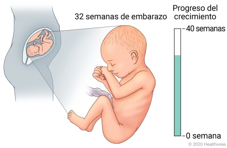 Feto en útero, con detalle de desarrollo a 32 semanas de embarazo