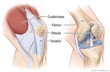 Alt text: Articulación de rodilla doblada, que muestra cuádriceps que se convierten en el tendón rotuliano y, junto con el hueso (fémur), se conectan a la rótula desde arriba