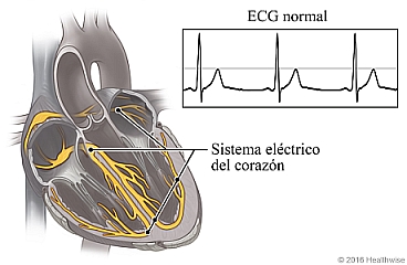 ecg anormal etiquetado