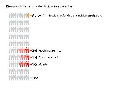 Gráfico que muestra los riesgos de la cirugía de derivación vascular