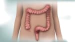 Colonoscopy: Overview