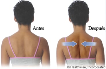 Ejercicio de compresión de los omóplatos