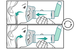 El niño inhala y exhala a través de una cámara de inhalación con mascarilla.