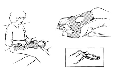 Drenaje postural para los lóbulos inferiores (segmento posterior)