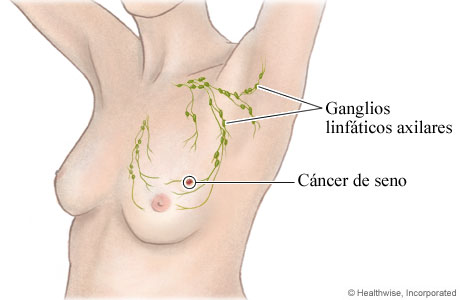 Ganglios linfáticos axilares y su ubicación