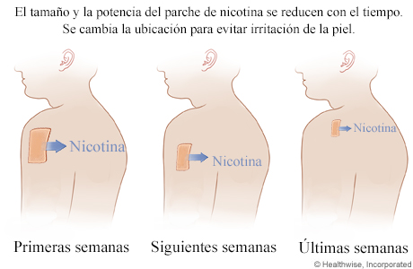 Cómo se usa un parche de nicotina.