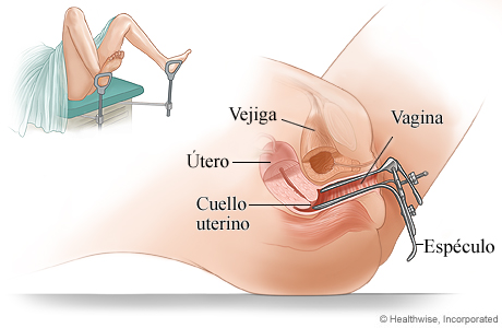 Examen pélvico con espéculo