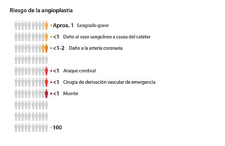 De cada 100 personas que se someten a una angioplastia, aproximadamente 1 tendrá sangrado grave o daño a un vaso sanguíneo a causa del catéter; alrededor de 1 a 2 tendrán daño a la arteria coronaria; aproximadamente 1 tendrá un ataque cerebral o necesitará una cirugía de derivación vascular ("bypass") de emergencia, y aproximadamente 1 morirá.