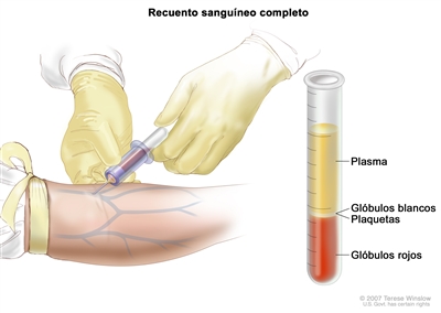 Recuento sanguíneo completo (RSC); en el panel de la izquierda se observa que se extrae sangre de una vena de la parte anterior del codo por un tubo conectado a una jeringa; en el panel de la derecha, se observa un tubo de ensayo de laboratorio con células sanguíneas separadas en capas: plasma, glóbulos blancos, plaquetas y glóbulos rojos.