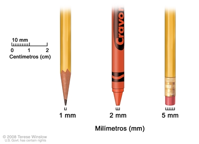 Milímetros; el dibujo muestra los milímetros (mm) usando objetos comunes. La punta de un lápiz afilado mide 1 mm, la punta de un lápiz de cera mide 2 mm y la goma de borrar nueva de un lápiz mide 5 mm.