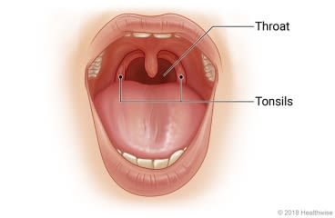 Location of tonsils and throat