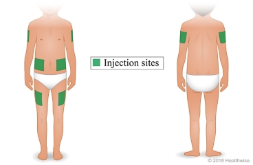 Child's body, showing injection sites on thigh, back of upper arm, and belly at least 2 inches to side of belly button