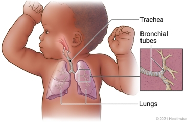 Baby's respiratory system including trachea, bronchial tubes, and lungs, with detail of bronchial tubes inside lung.