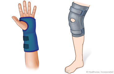 Splint on wrist and splint on knee