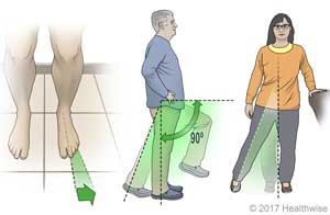 Three examples of safe positions of foot, knee, and leg after surgery